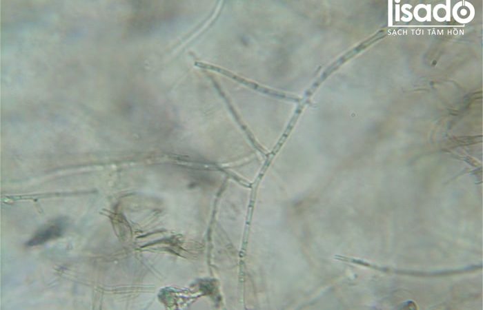 Fusarium solani là loại nấm gây ra bệnh thối thân trên cây dưa lưới